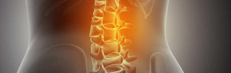 SPINE-SOLUTIONS